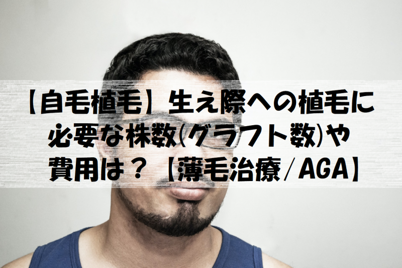 自毛植毛 生え際への植毛に必要な株数 グラフト数 や費用は 薄毛治療 Aga しろもふメンズ美容ラボ